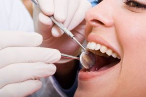 Dental Insurance in Immokalee, Collier County, FL